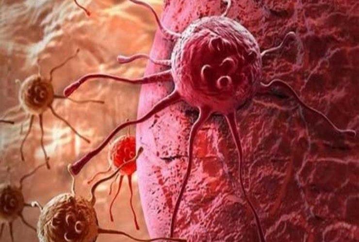 اكتشفها باحثون في 2022.. 6 أشياء قد ترتبط بالسرطان.