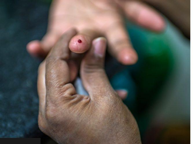 تقرير للصحة: (337973)، عدد المصابين بالسكري بالخرطوم