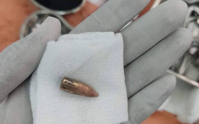 إجراء عمليات جراحية معقدة بنجاح بمستشفى (الجكيكة) بالخرطوم