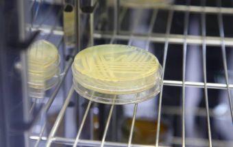 الشمالية تسجيل أول حالة وفاة بالكوليرا