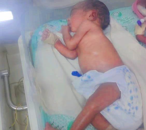 سيده تضع خمسة توأم بمستشفى القضارف للنساء والتوليد