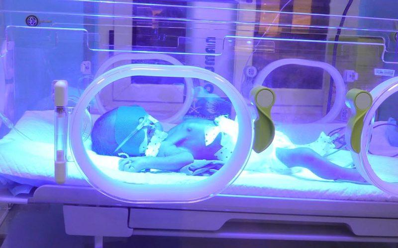 شراكة دولية لإنقاذ حياة المواليد: تدشين حضّانات حديثي الولادة بمستشفى الأطفال